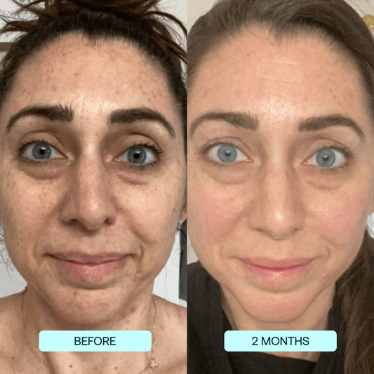 Plump Peepers Collagen Boost